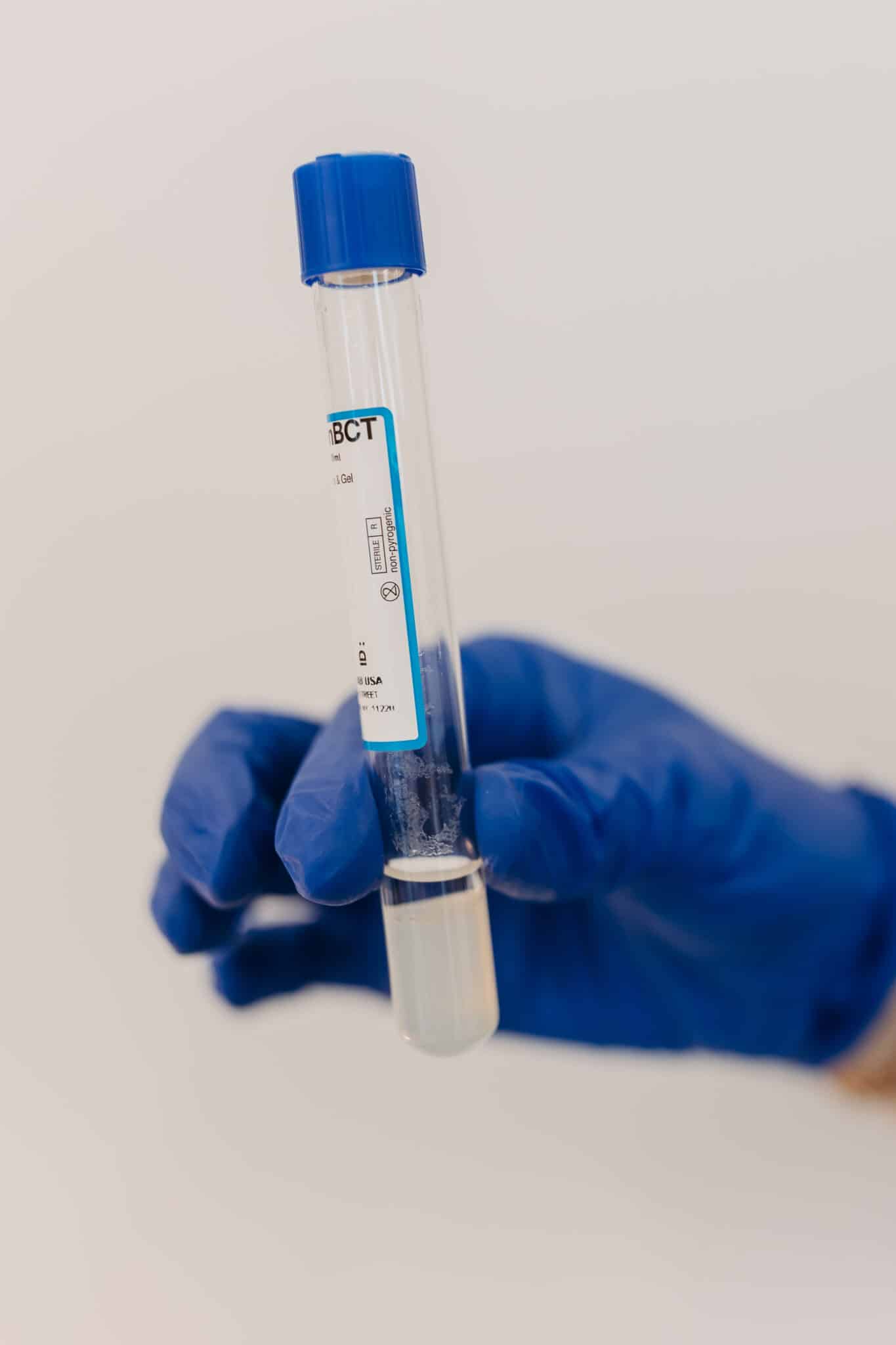 A person's gloved hand holds a test tube with a blue cap and label, possibly for medical or laboratory use, against a white background.