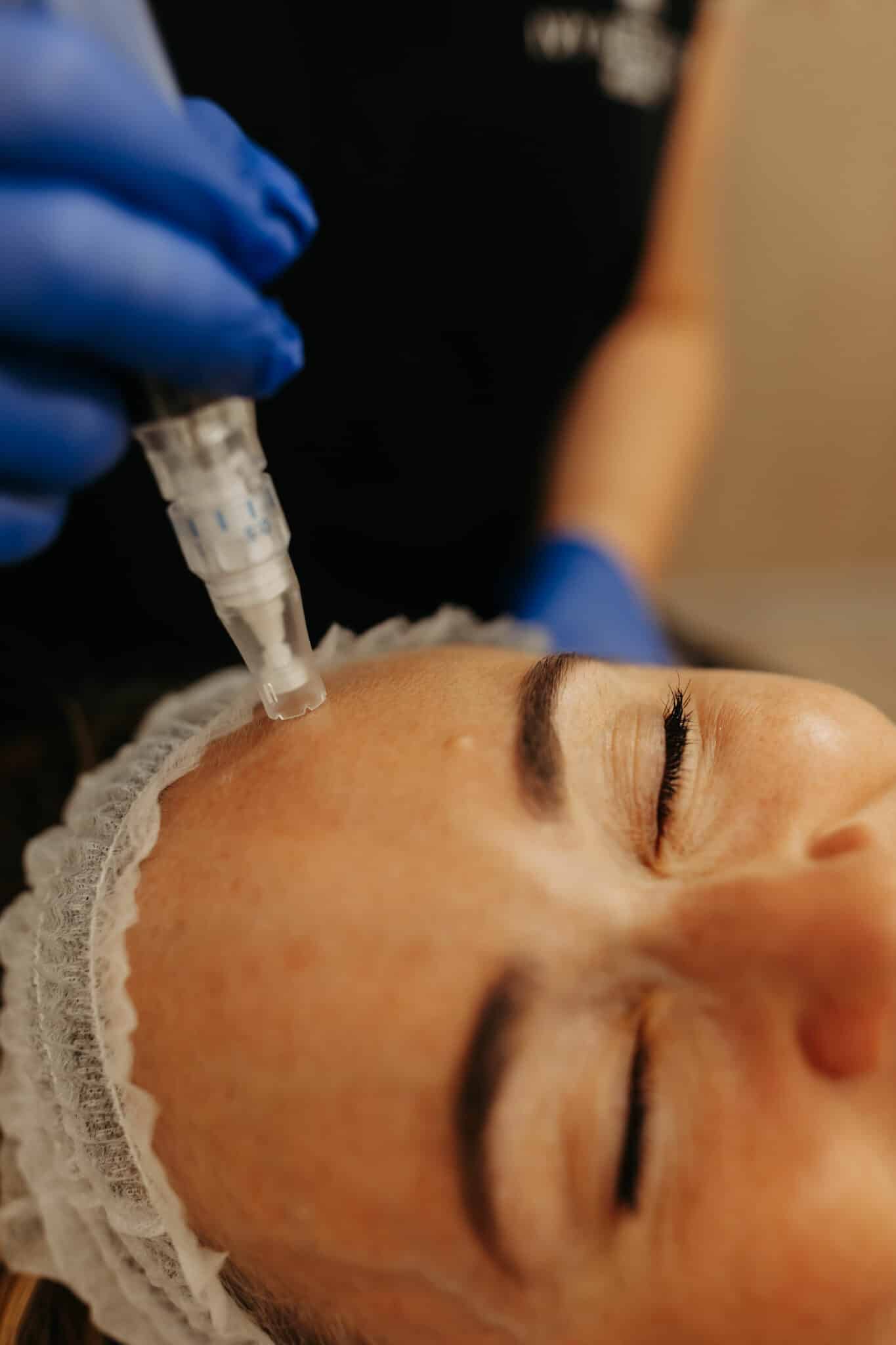 A person in a hairnet receives a facial injection from someone wearing blue gloves, suggesting a medical or cosmetic procedure. Close-up, focused on treatment area.