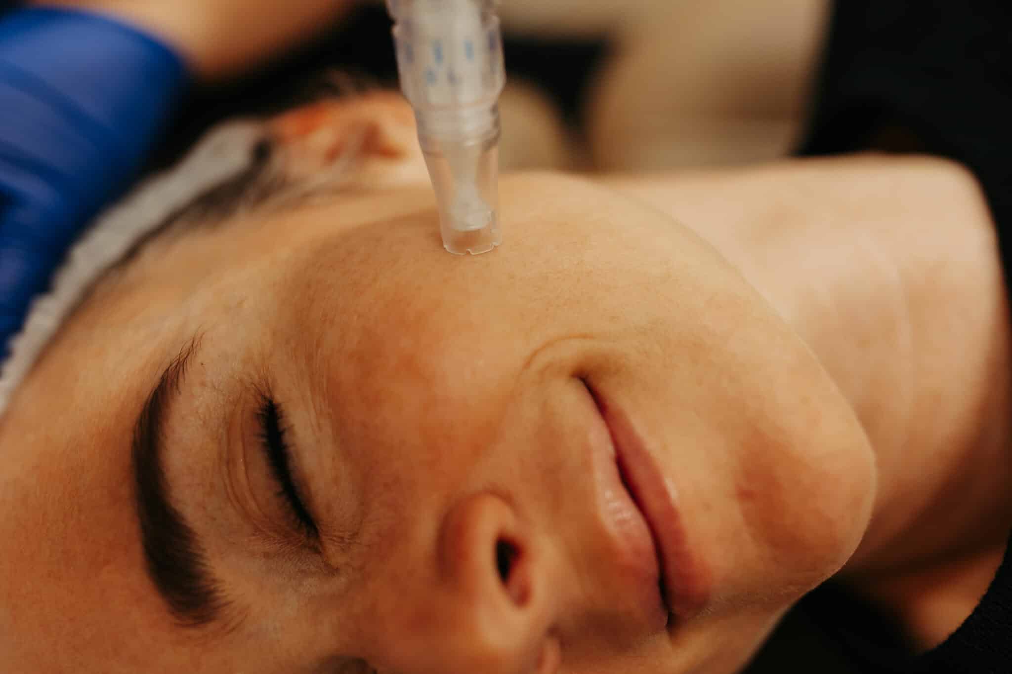 Close-up of a person's face lying down with their eyes closed. A nasal cannula provides oxygen, indicating medical care or assistance with breathing.