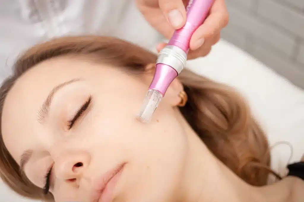 A person is receiving a facial treatment with a pink dermapen device, targeting the cheek area in a clinical or spa setting.