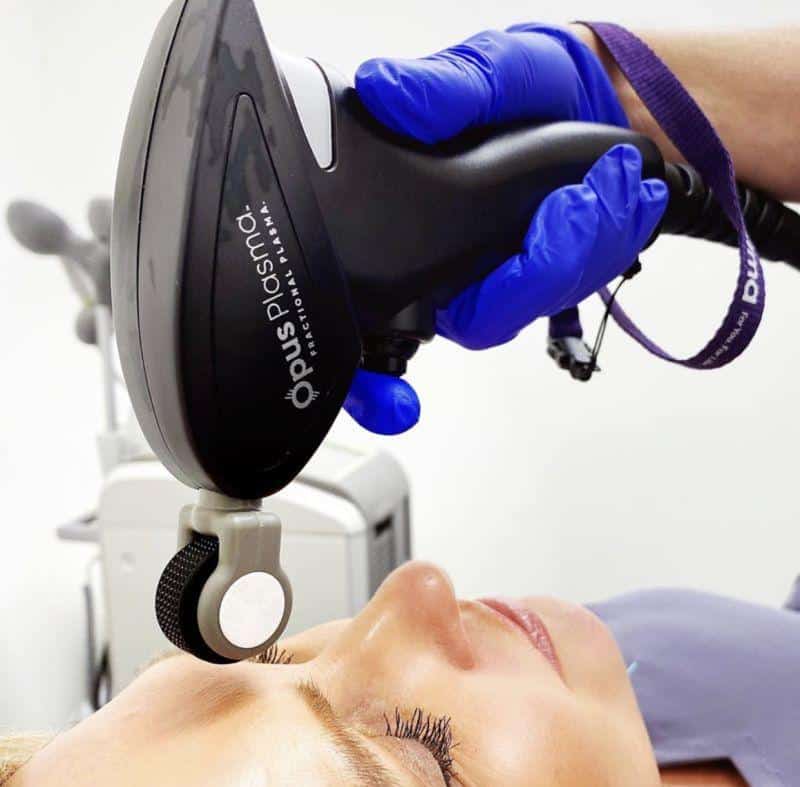 A person in blue gloves operates a medical device over the face of a reclining person, likely performing a cosmetic or dermatological procedure.