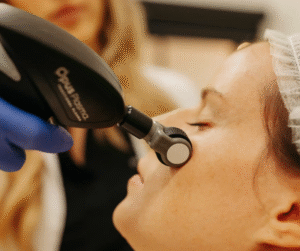 A person undergoes a facial treatment using a handheld medical device, operated by another individual wearing blue gloves, in a clinical setting.