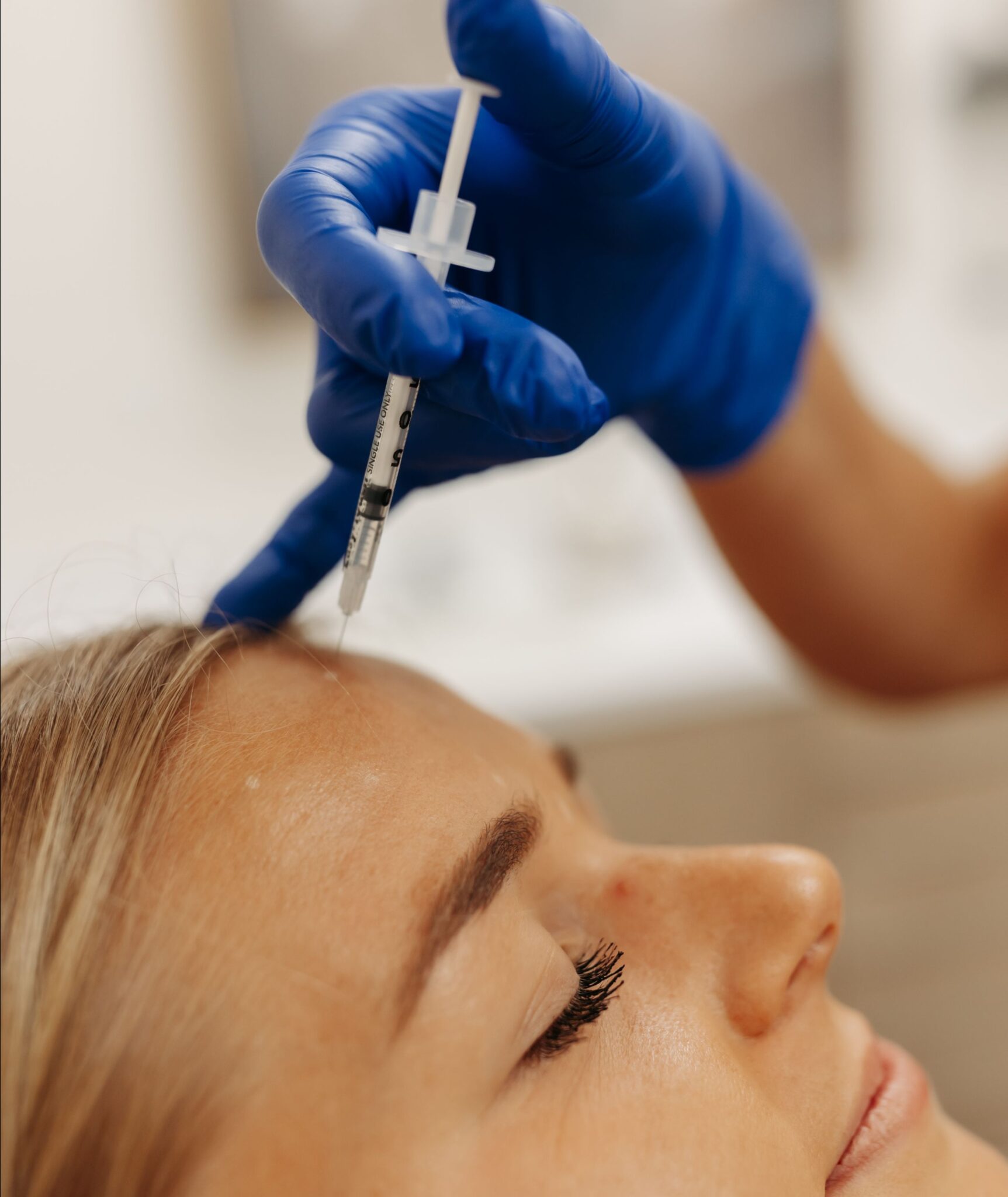 A person receives a cosmetic injection in the forehead. A gloved hand holds the syringe, highlighting a clinical setting.