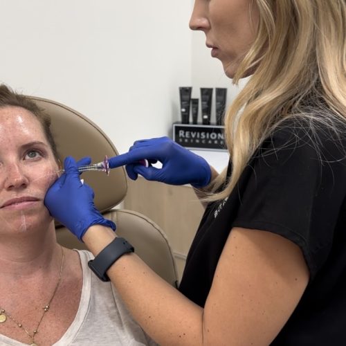 A person in a black shirt is administering a facial treatment to another person using a blue-handled instrument in a clinical setting.